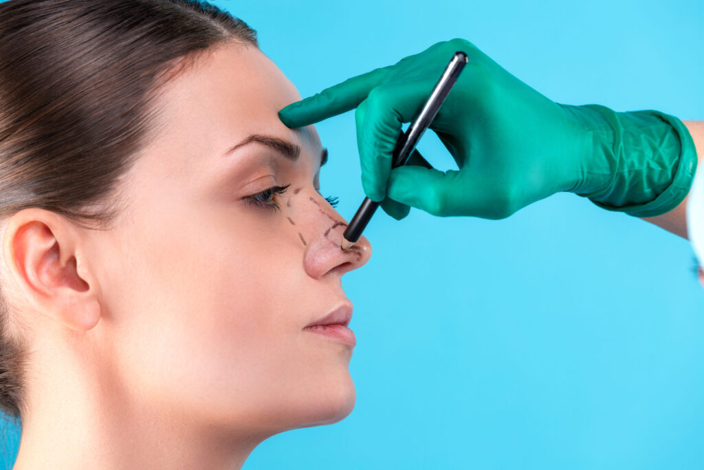 Preparan a paciente para Rinoplastia Ultrasónica.-