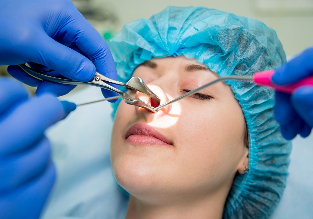 En plena rinoplastia de Preservación