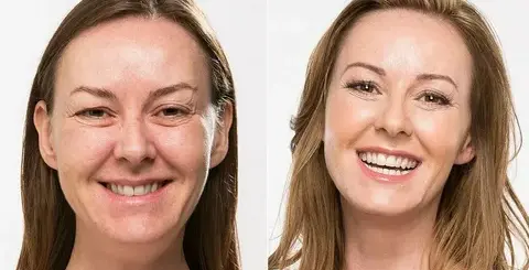 Recomendaciones-para-verte-más-joven