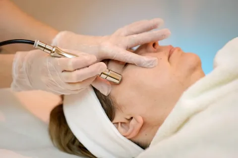 dermabrasión-en-la-piel