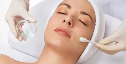 el-peeli-ng-químico