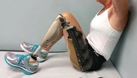 prótesis-de-glúteos