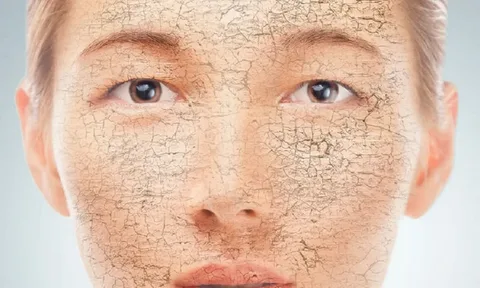 El-estrés-afecta-tu-piel