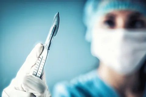 La-cirugía-sin-bisturí