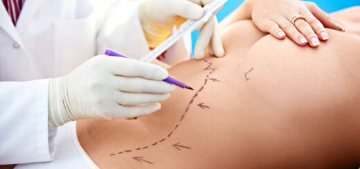 latinoamerica-boom-cirugia-estetica
