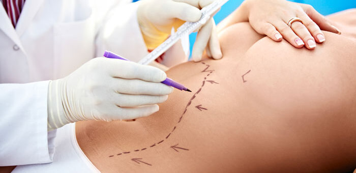 latinoamerica-boom-cirugia-estetica