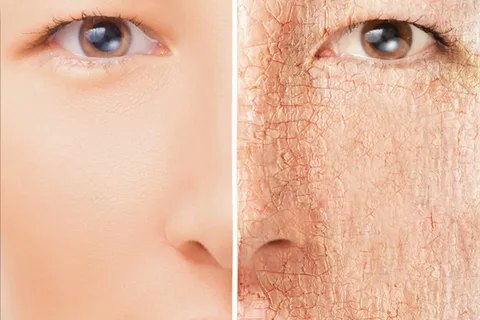 Cómo-se-debe-cuidar-cada-tipo-de-piel