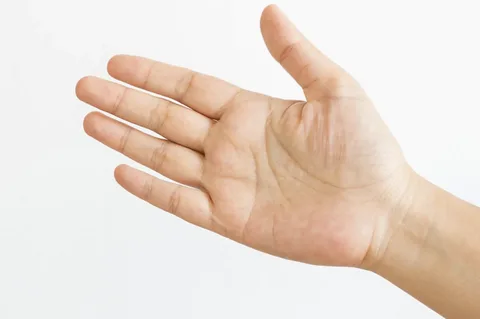 La-cirugía-para-aumentar-las-líneas-de-la-mano
