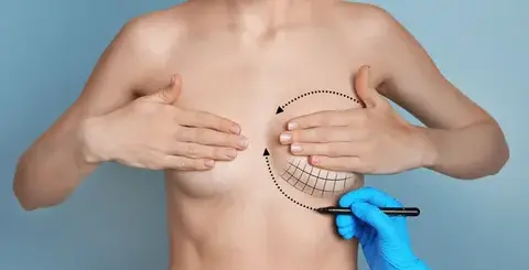 Qué-riesgos-hay-en-la-prótesis-de-mamas