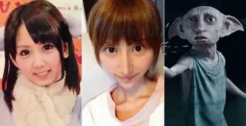 Rina Nanase realiza cirugías y tiene parecido a elfo de Harry Potter