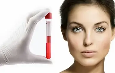 Aplicación-del-plasma-rico-en-plaquetas