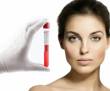 Aplicación-del-plasma-rico-en-plaquetas