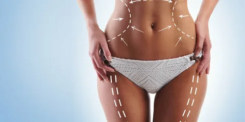 Cirugía-íntima-Precios