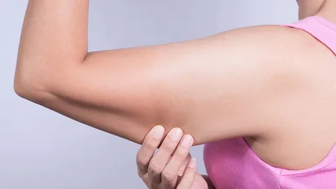 La-cirugía-estética-de-brazos