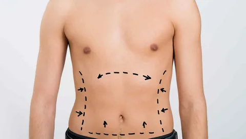 La-cirugía-estética-para-hombres