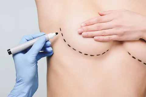 La-mamoplastia-de-aumento-y-reducción