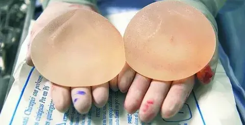 La-nueva-era-en-los-implantes