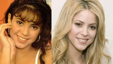 La-rinoplastia-en-famosos