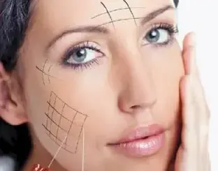 Qué-puede-corregir-los-hilos-rusos