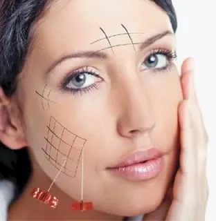 Qué-puede-corregir-los-hilos-rusos