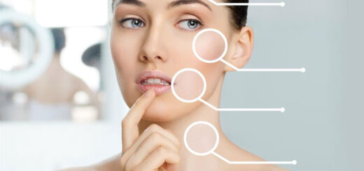 botox-antes-y-despues-resultados