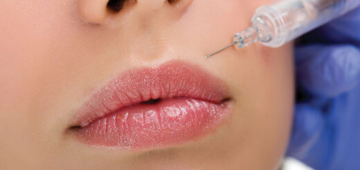 botox-mitos-verdades