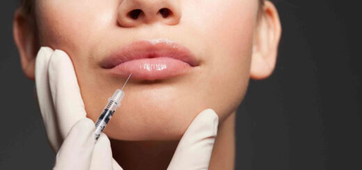 relleno-de-labios-recomendaciones