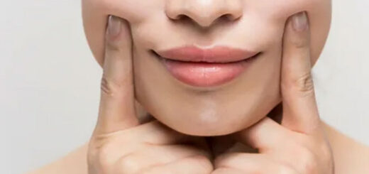 tratamiento-de-surcos-nasogenianos