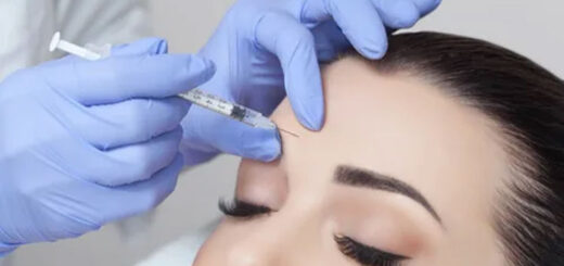 botox-tratamiento-arrugas-faciales