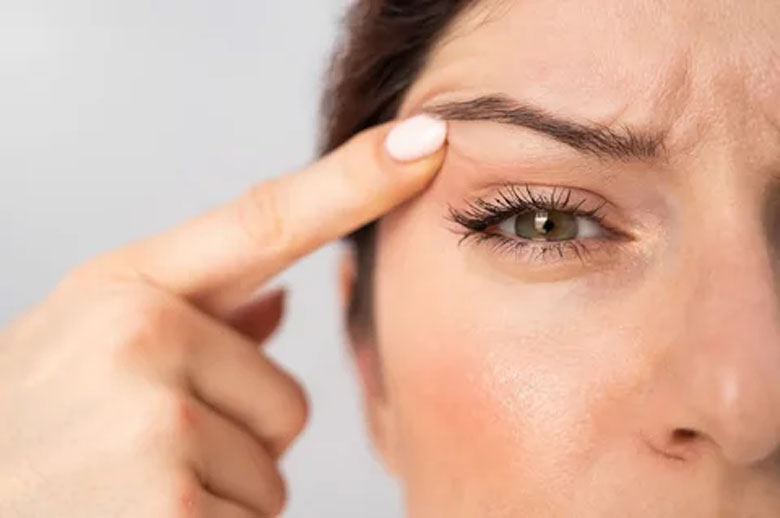 blefaroplastia-secretos-exitosos