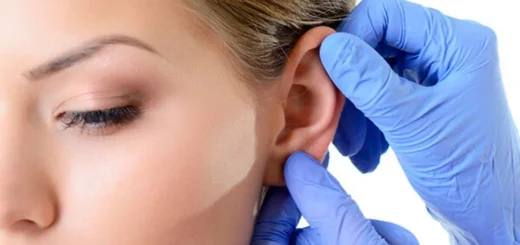 otoplastia-cirugia-de-orejas