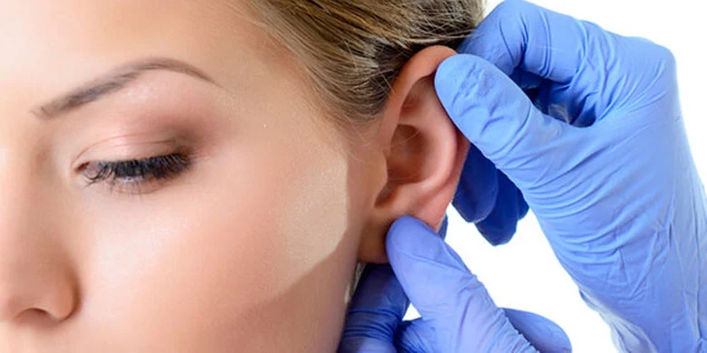 otoplastia-cirugia-de-orejas