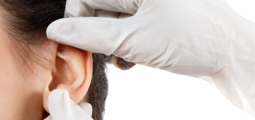 Otoplastia-en-adultos-ninos