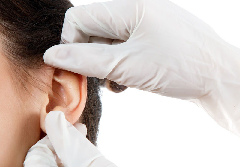 Otoplastia-en-adultos-ninos