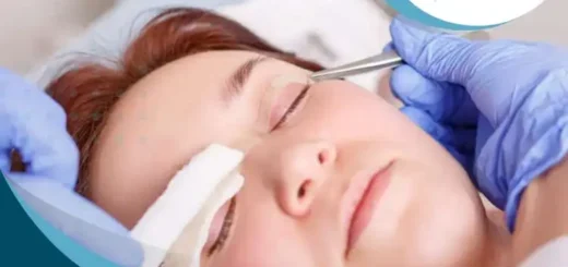 despues-blefaroplastia