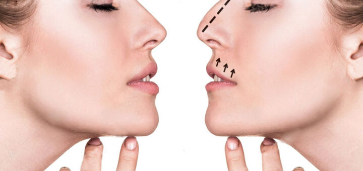 rinoplastia-personalizada