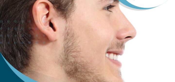 rinoplastia-para-hombres