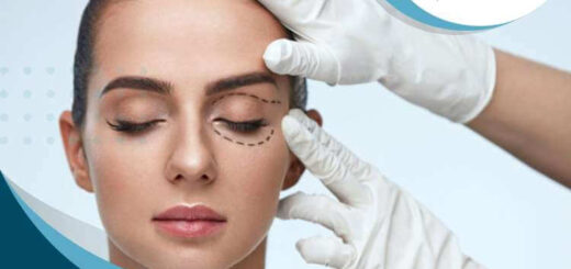 blefaroplastia-cuidado-resultados