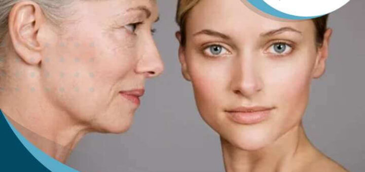 ritidoplastia-en-lima