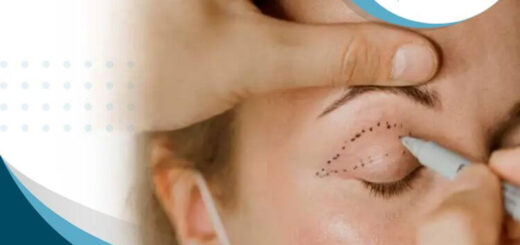 blefaroplastia-superior-procedimiento