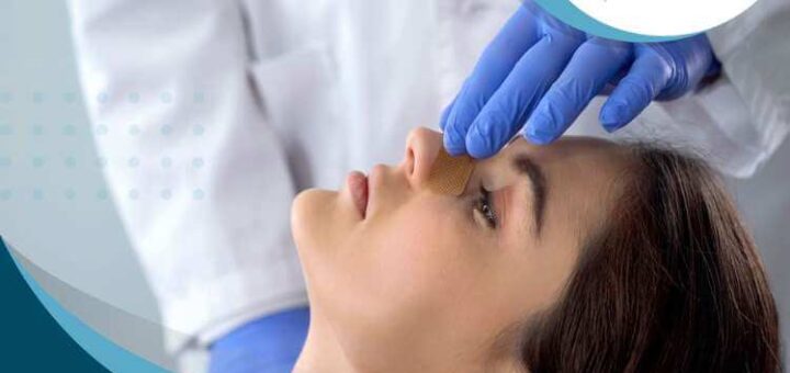 evolucion-rinoplastia