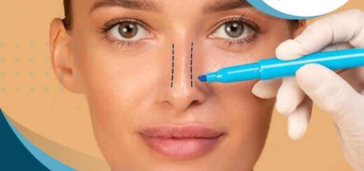 todo-sobre-rinoplastia