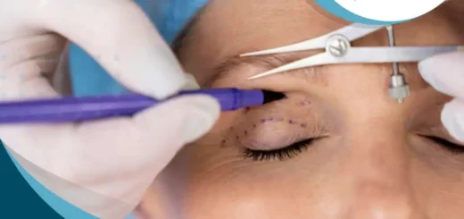 blefaroplastia-estetica-imagen-renovada
