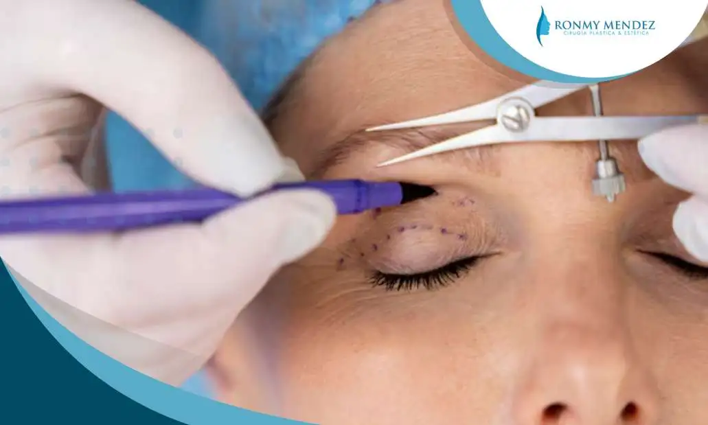 blefaroplastia-estetica-imagen-renovada