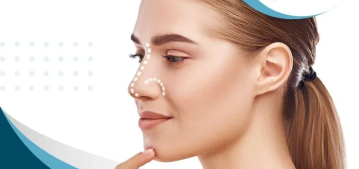 rinoplastia-en-adolescentes-ventajas-beneficios