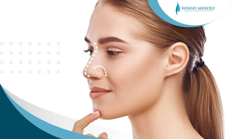 rinoplastia-en-adolescentes-ventajas-beneficios