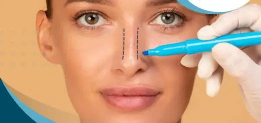 rinoplastia-para-mujeres
