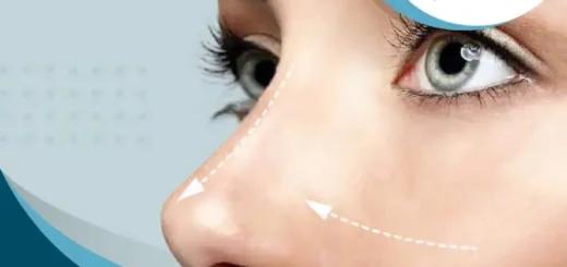 tipo-rinoplastia-para-mujeres