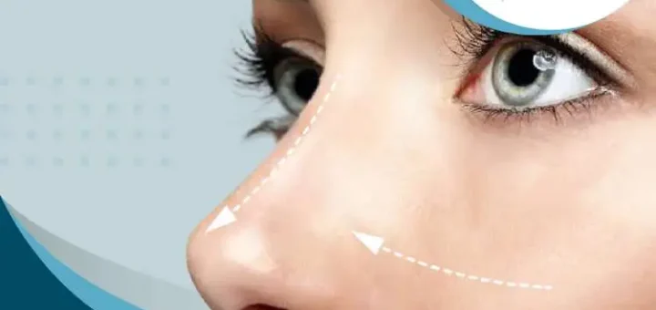 tipo-rinoplastia-para-mujeres