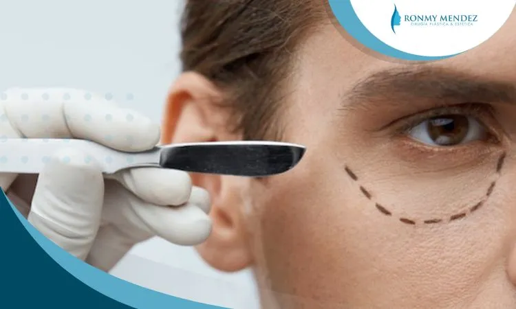 blefaroplastia-para-hombres